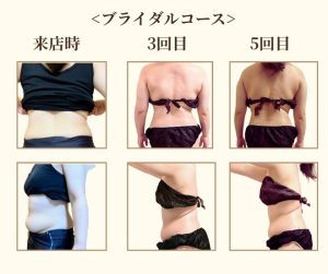 ✢ブライダルコース✢
全身リンパトリートメントの経過